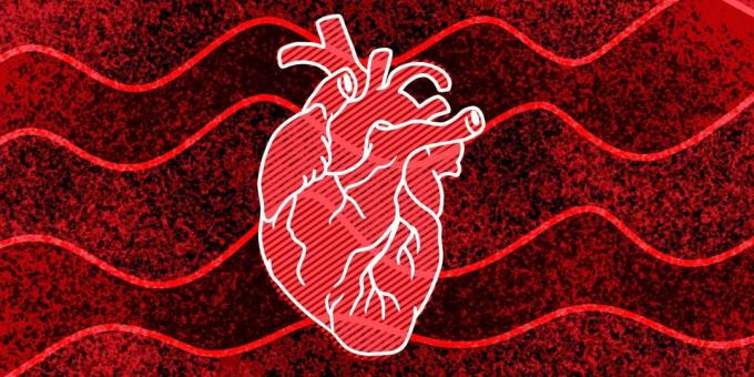 11 סימנים שאתה עלול לקרות מדום לב