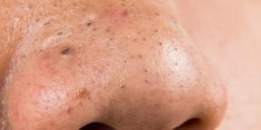 הגיע הזמן להתוודות: ניקוי הפנים לא יחסוך אותך מנקבוביות סתומות ומוגדלות